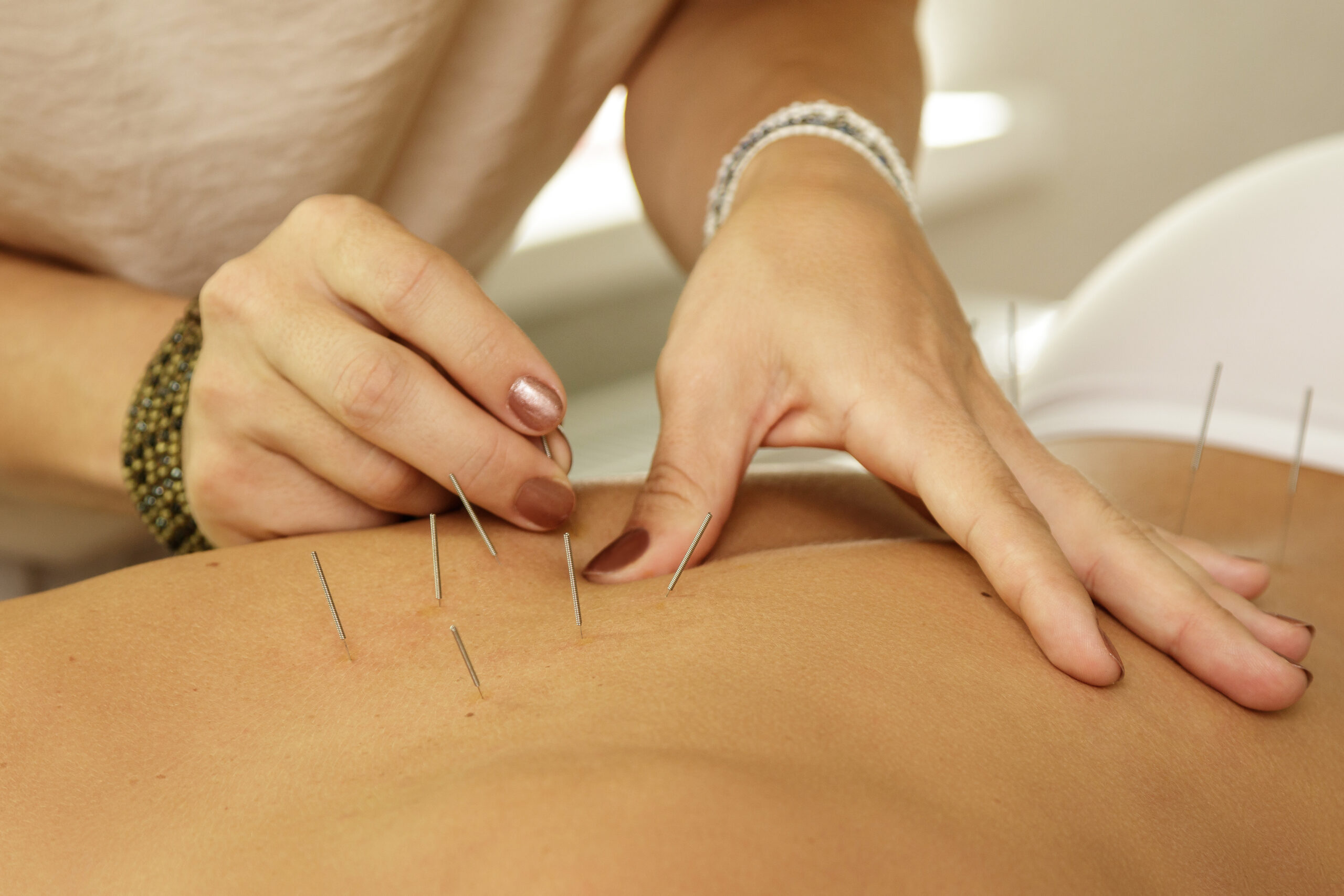 Master is injecting steel needles during procedure of acupunctur