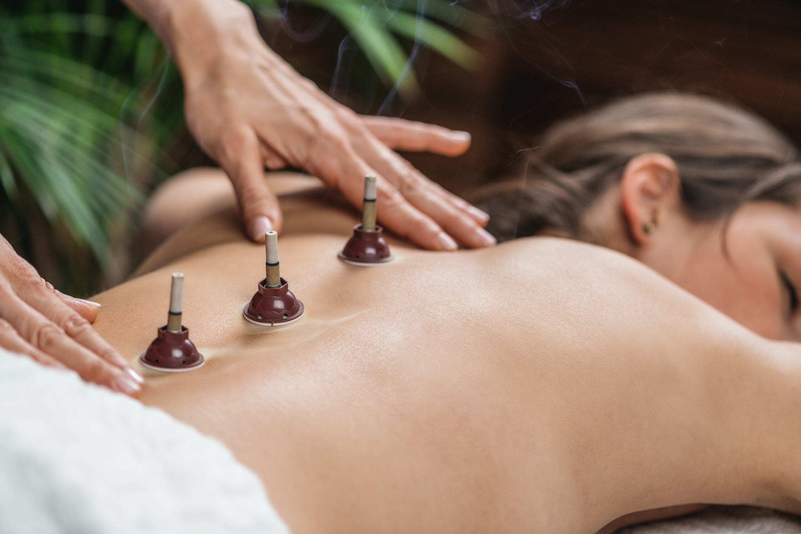 Moxibustion Traditional Chinese Medicine Treatment